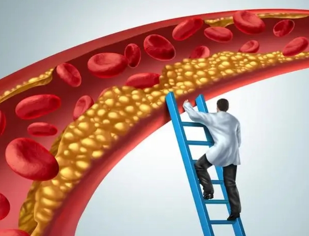 阿托伐他汀是治什么的？优选原研药、长期使用，有效降脂第一步(图2)